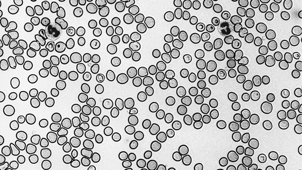 Medical Data Visualization